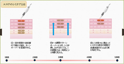 魔法のシミケアマシンの説明